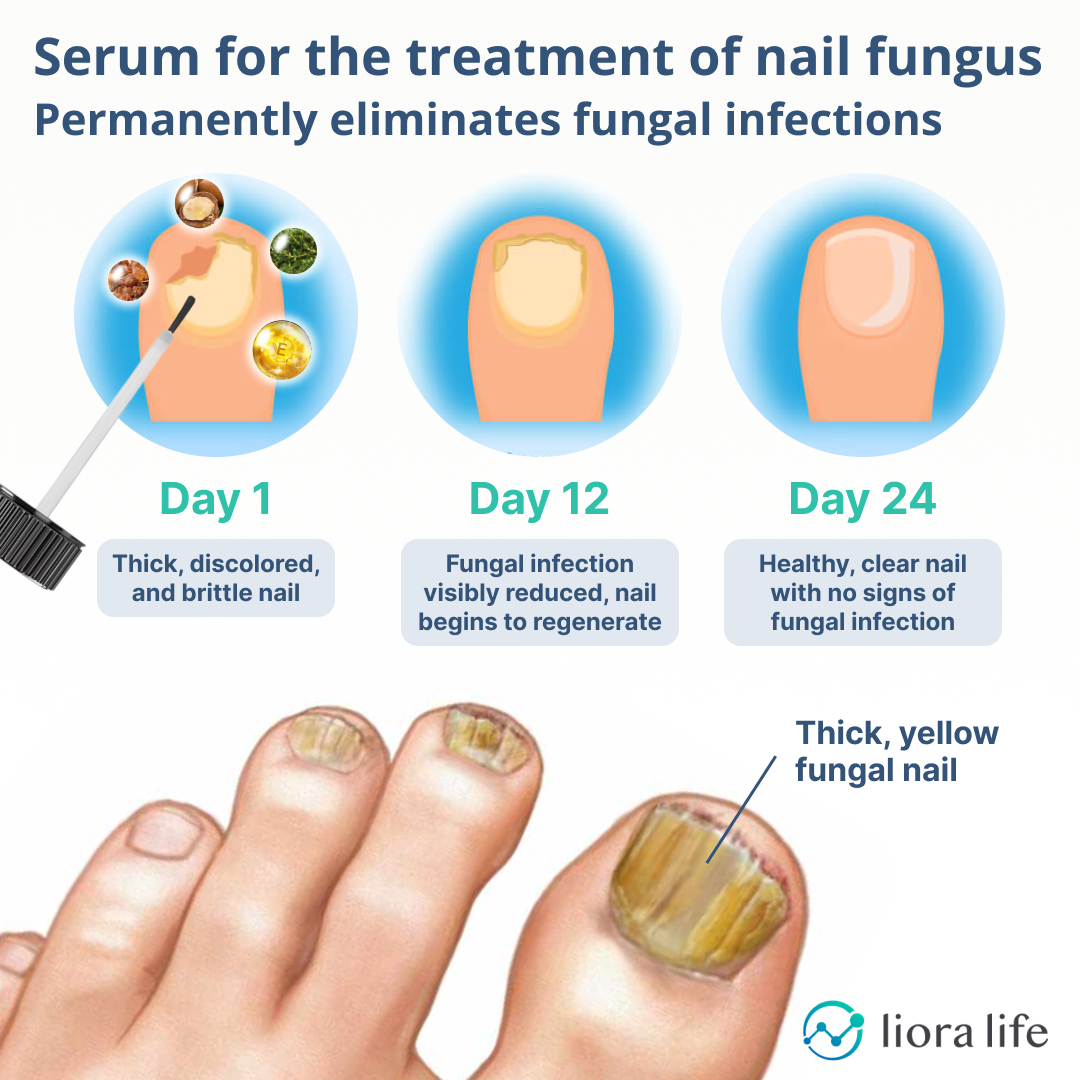 Fungi-Fix